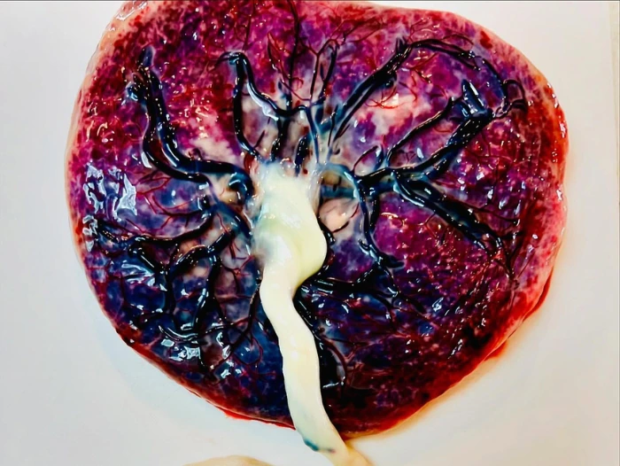 the-spiritual-and-Indigenous-significance-of-the-placenta (1) The Spiritual and Indigenous Significance of the Placenta